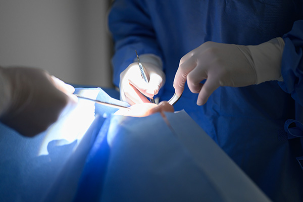 インプラントのメリット／デメリット